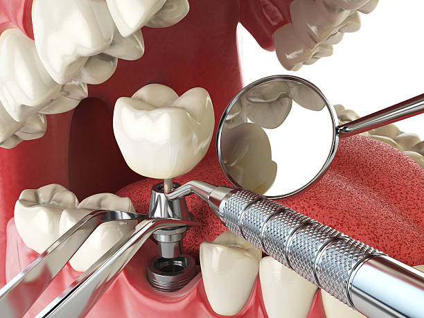Best Orthodontic Emergency Dentist in Calvert, TX