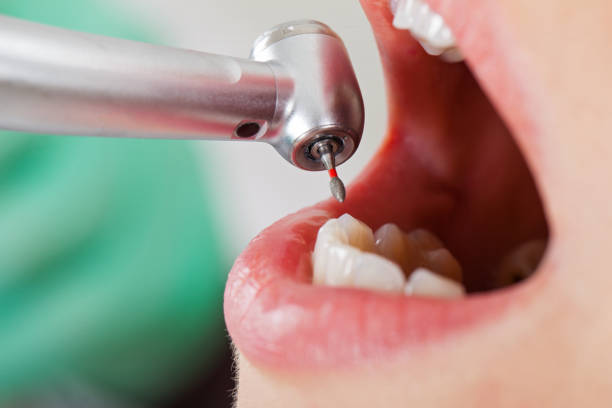 Best Urgent Dental Care for Toothache in Calvert, TX